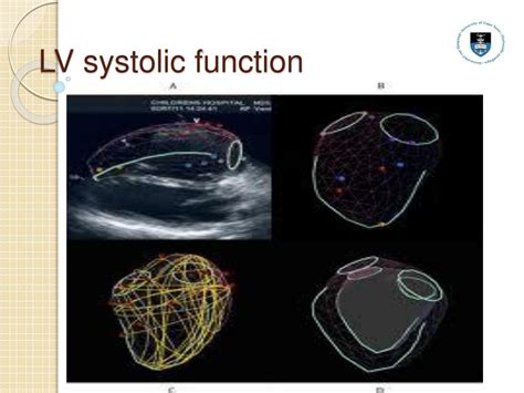lv systolic